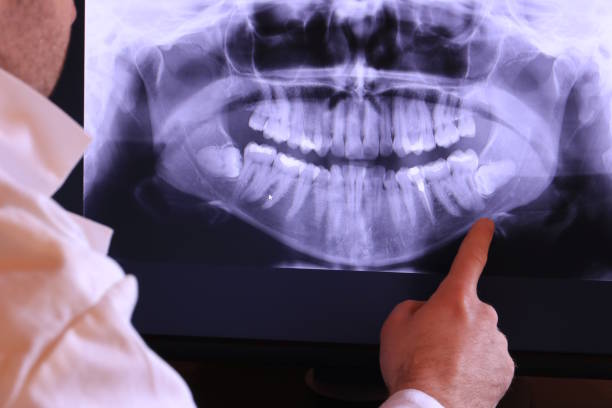 Best Dentist for Tooth Abscess  in Aberdeen, NC